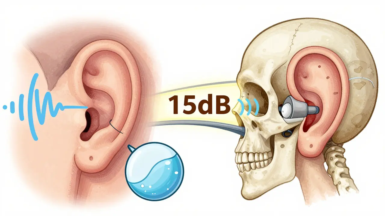 Side-by-side illustration of air and bone conduction pathways with a glowing air-bone gap.